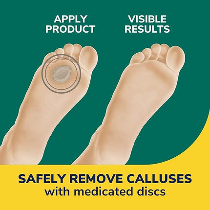 Dr. Scholl Extra Thick Callus Removers 4ct-2